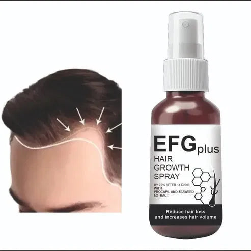 Hair Growth Spray โ 50ml (Pack of 2)