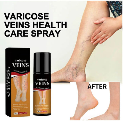 Varicose Veins Spray ( Pack of 2)