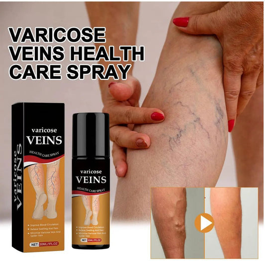 Varicose Veins Spray ( Pack of 2)